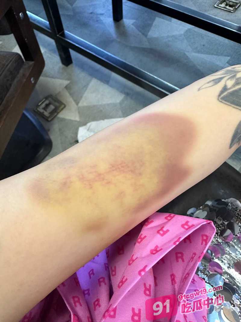 柬埔寨骗财骗色家暴男 林鑫龙 金牌女扶手自爆遇到他差点被打死 配图2