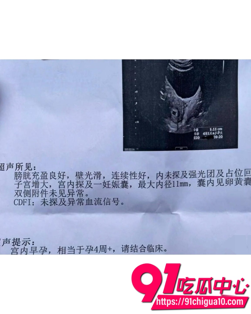 知名演员李沁 35