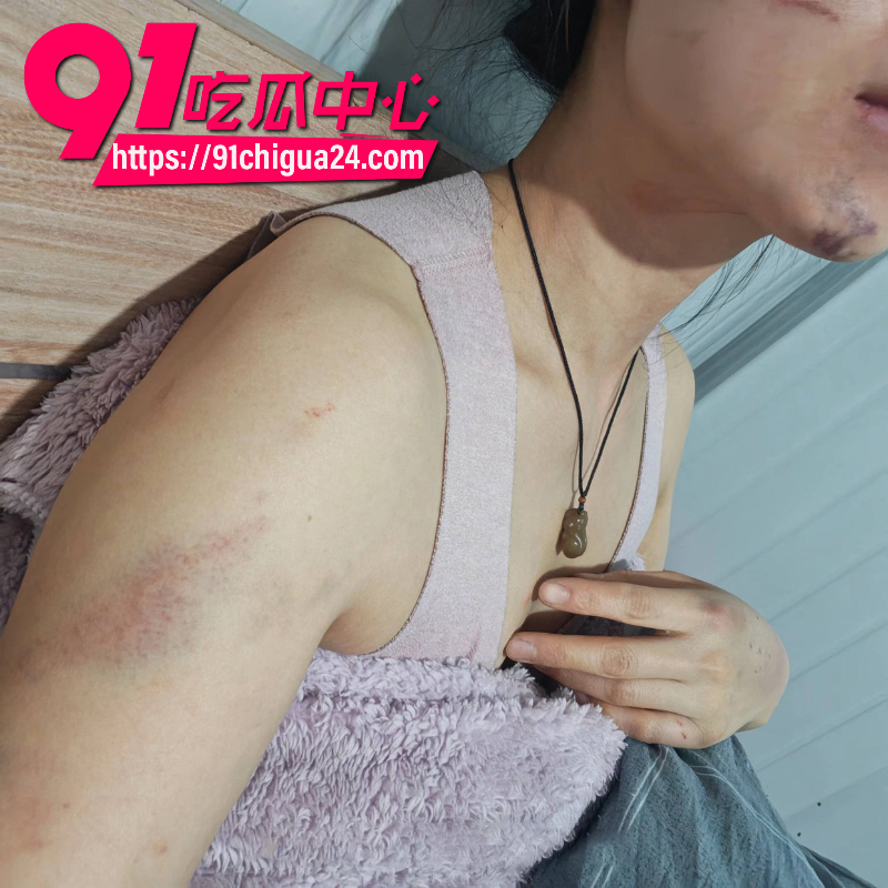 千万大V张百乔家暴老婆视频流出老婆迅速网上辟谣24 千万大V张百乔家暴老婆视频流出老婆迅速网上辟谣24