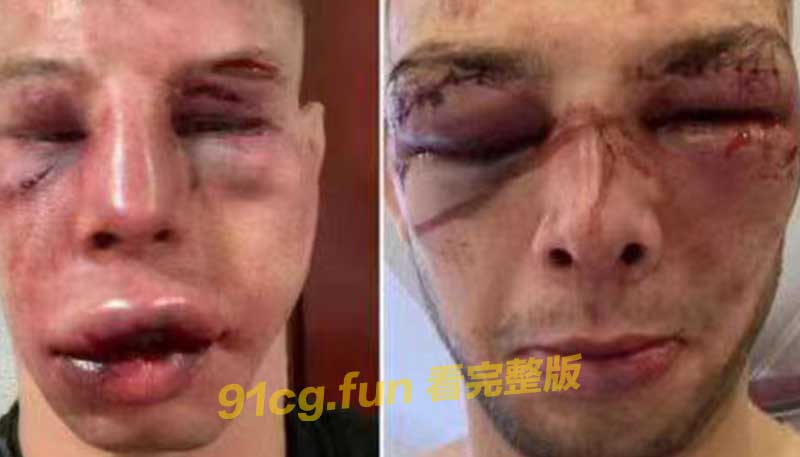 波兰MMA Attack 4拳击手地面战 面目全非血肉模糊连妈妈都认不得