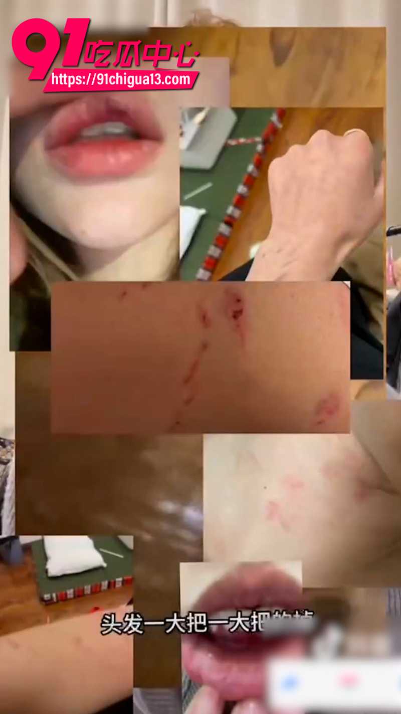 抖音女网红达哇措被好闺蜜找人暴打15