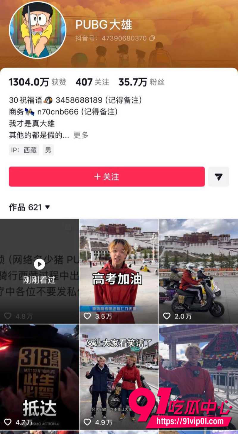 小伙车祸2 小伙车祸2