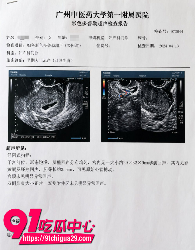 抖音700W粉丝女网红贵阳二小姐知三当三勾引杰少偷情被庄楚华实名举报24 抖音700W粉丝女网红贵阳二小姐知三当三勾引杰少偷情被庄楚华实名举报24