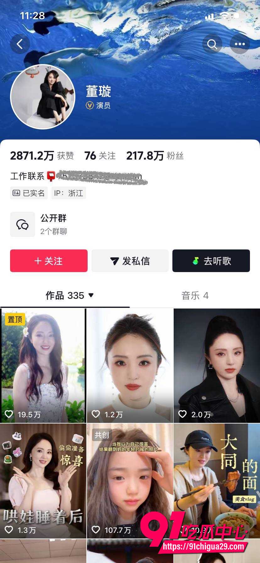 娱乐圈大瓜 张婉婷自爆给高云翔当小三怀孕被逼打掉 宋宁峰出轨后劝小三退让瓜太抓马了！