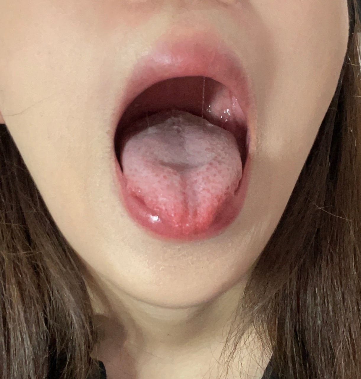 菏泽单县24